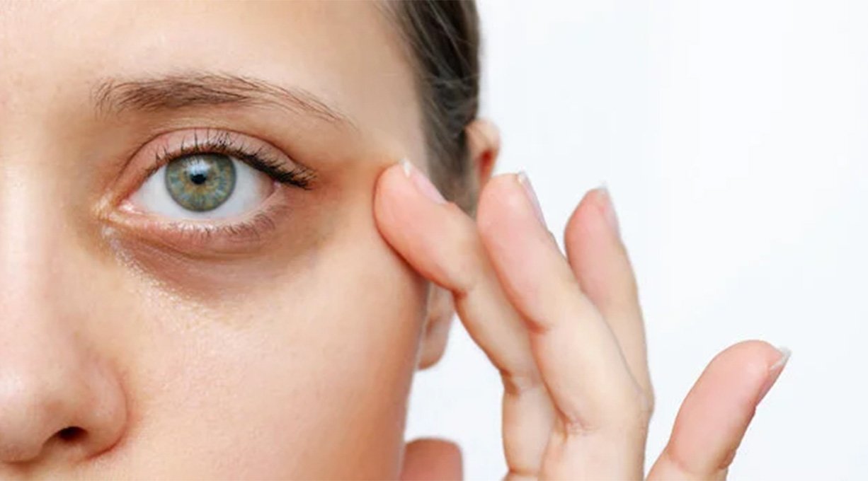 comment-enlever-cernes-2_1226x680