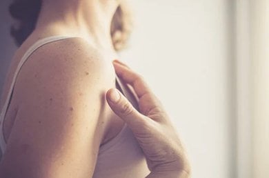 comment-proteger-cicatrice-soleil_1226x680