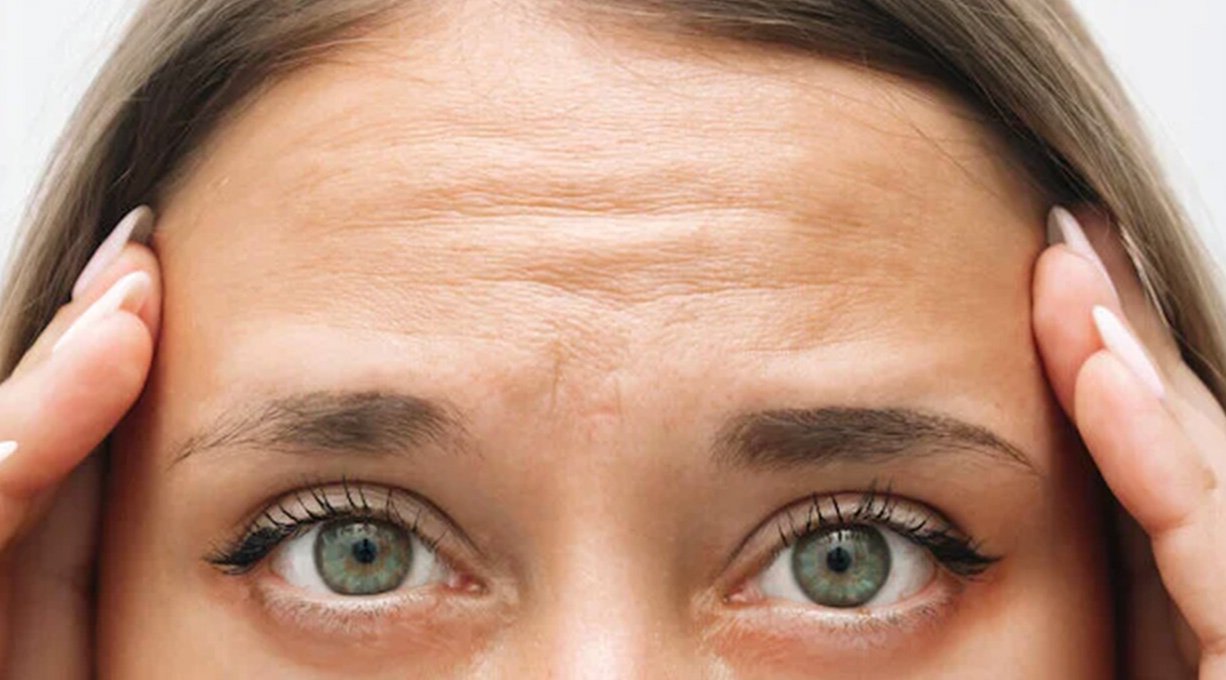 rides-du-front-comment-l-acide-hyaluronique-peut-les-combler