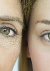 rides-sous-les-yeux-mode-d-emploi-pour-les-prevenir-et-les-attenuer