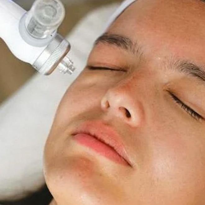 Femme effectuant du laser autour de ses yeux pour enlever les cernes