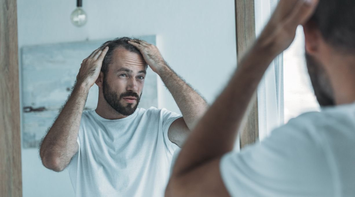 chute de cheveux chez l'homme : solutions