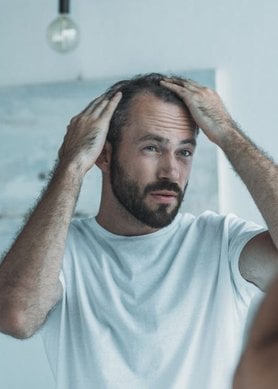 chute de cheveux chez l'homme : solutions