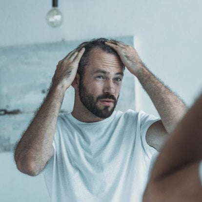 chute de cheveux chez l'homme : solutions