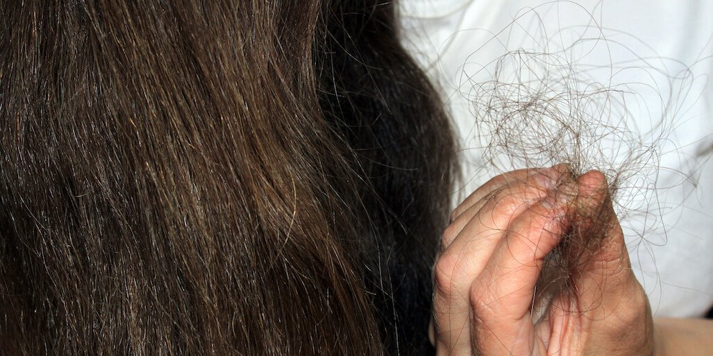 chute-de-cheveux-post-partum