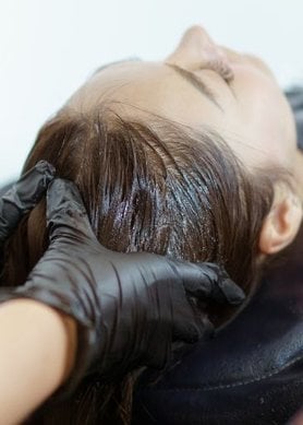Minoxidil chute de cheveux