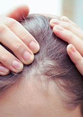 perte de cheveux chez la femme : que faire ?