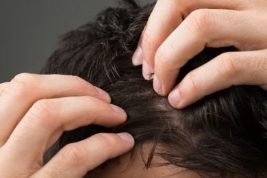 éliminer efficacement les pellicules