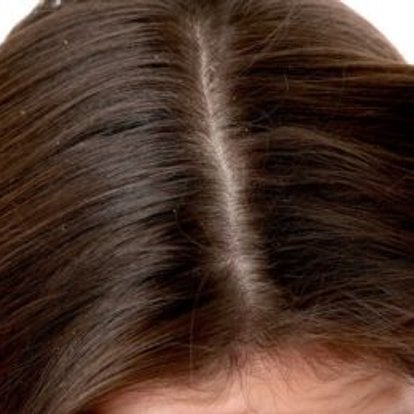 comment différencier une lente d'une pellicule ?