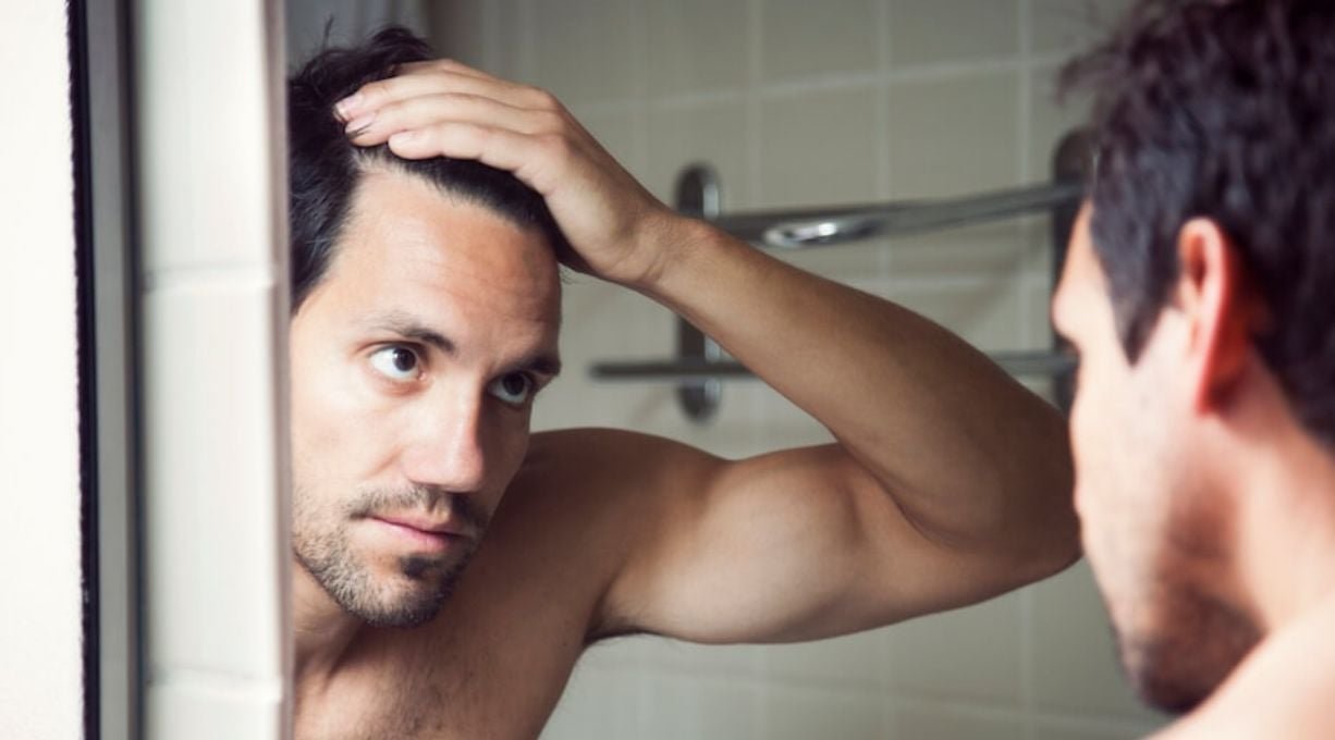 différence pellicules sèches et grasses