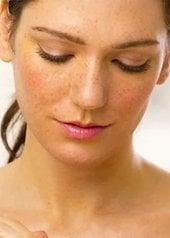 depigmentation-peau