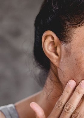 hyperpigmentation : comment l'atténuer ?
