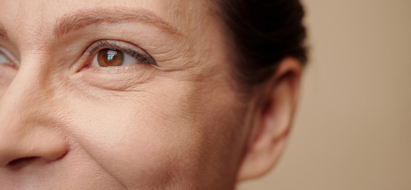 Femme de 45/50 ans présentant des rides sur le visage