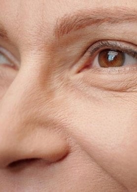 Femme de 45/50 ans présentant des rides sur le visage