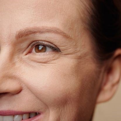 Femme de 45/50 ans présentant des rides sur le visage